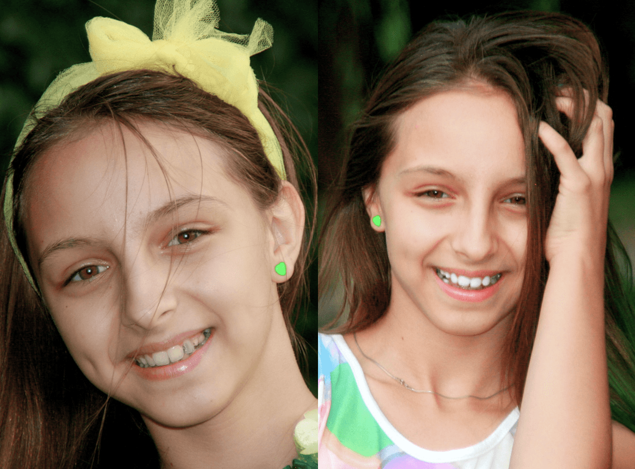 МАКСИМАЛЬНО КОМФОРТНА СТРАТЕГІЯ ЛІКУВАННЯ 2