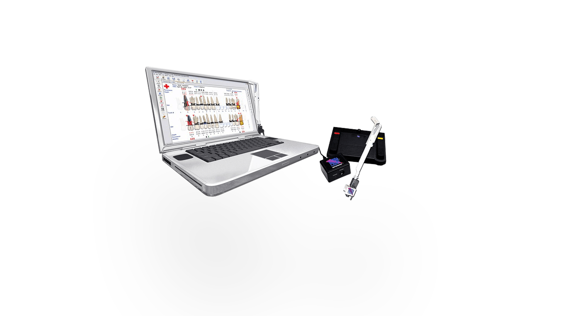 Лікування ясен